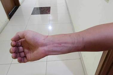 Chủ tịch Hà Nội yêu cầu làm rõ vụ hai nhà báo bị hành hung