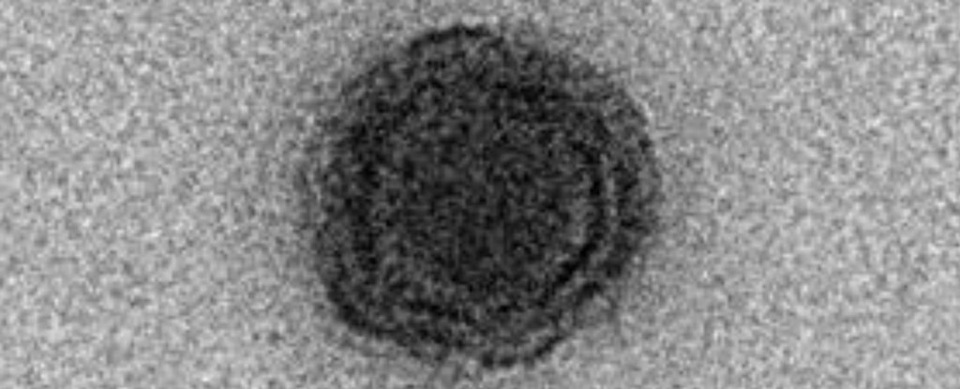 Phát hiện virus bí ẩn ở Brazil có bộ gene hoàn toàn mới - 1 Phát hiện virus bí ẩn ở Brazil có bộ gene hoàn toàn mới - 1