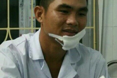 Hà Nội: Thiếu úy CSGT bị chém khi giải quyết va chạm giao thông