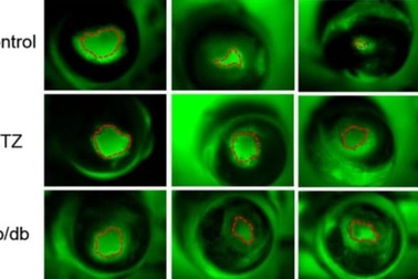 Tiếp xúc với điện có thể giúp chữa lành vết thương cho bệnh nhân tiểu đường