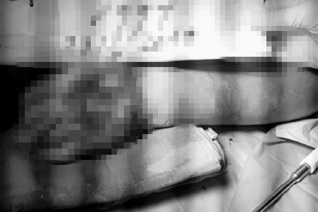 Bé trai 7 tuổi bị máy trộn bê tông cuốn nát tay khi đi chơi ở công trình - 1 Bé trai 7 tuổi bị máy trộn bê tông cuốn nát tay khi đi chơi ở công trình - 1
