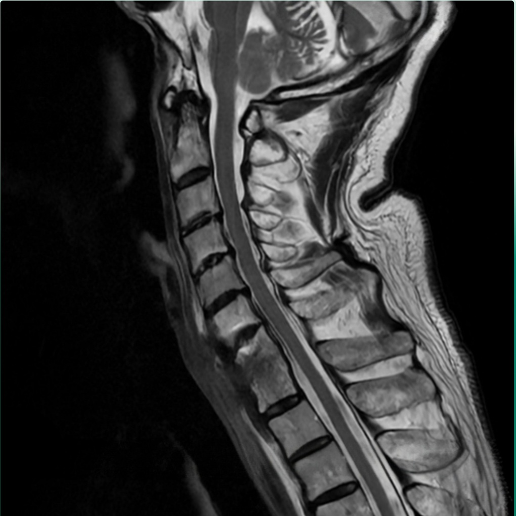 Giáo sư người Nhật mắc bệnh hiếm, sang Việt Nam điều trị thành công - 3 Giáo sư người Nhật mắc bệnh hiếm, sang Việt Nam điều trị thành công - 3