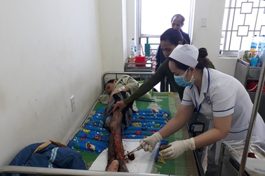 Bị hoại tử, chàng trai nghèo đau đớn với đôi chân bong tróc từng mảng da thịt