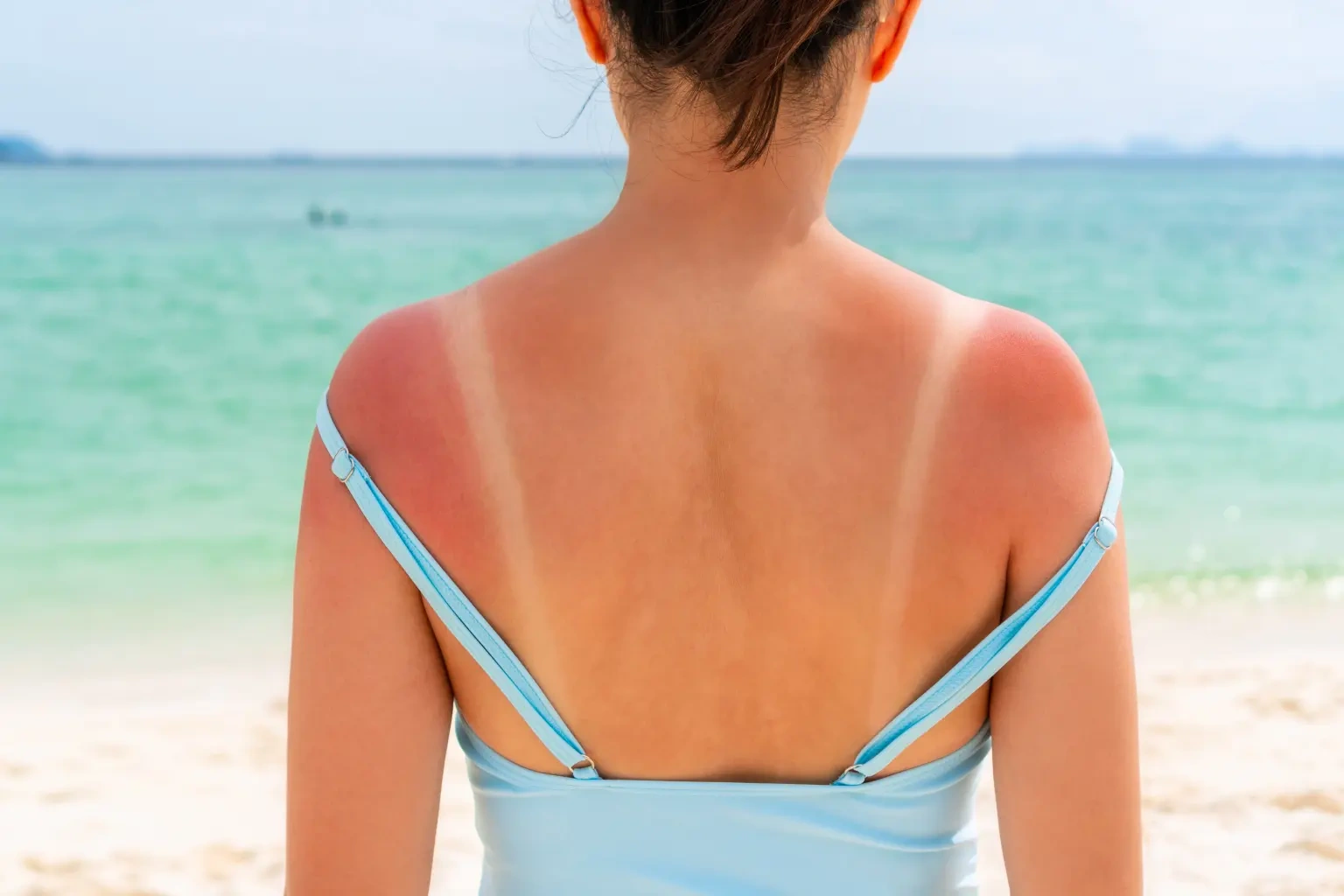 Warnung vor möglichen Risiken einiger Sonnenschutzmittel - 4 Cảnh báo nguy cơ tiềm ẩn từ một số loại kem chống nắng - 4