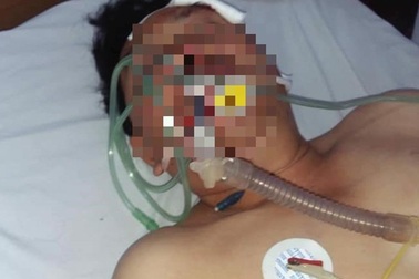 Nhận nợ thua độ cho người thân, bị "xã hội đen" đánh chết