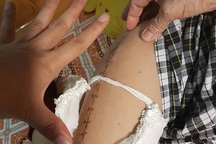 Vụ học sinh gãy chân trong trường: Gia đình bác bỏ trần tình của Hiệu trưởng