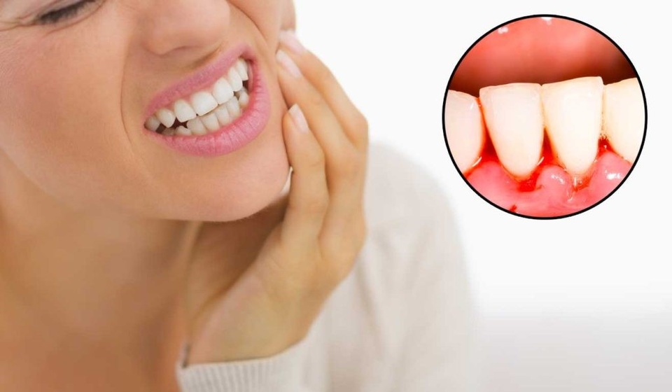 Nhìn thấy đồ ăn dầu mỡ là buồn nôn: Có thể gan đang gặp vấn đề - 3 Nhìn thấy đồ ăn dầu mỡ là buồn nôn: Có thể gan đang gặp vấn đề - 3