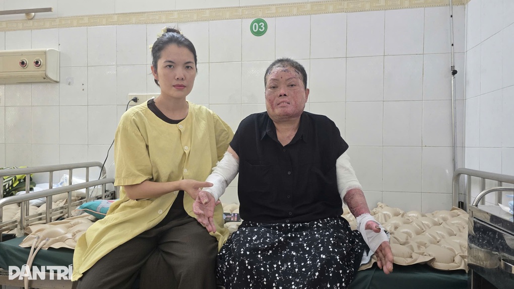 Hai nạn nhân vụ sét đánh ở Lào Cai đã hồi phục tích cực - 2