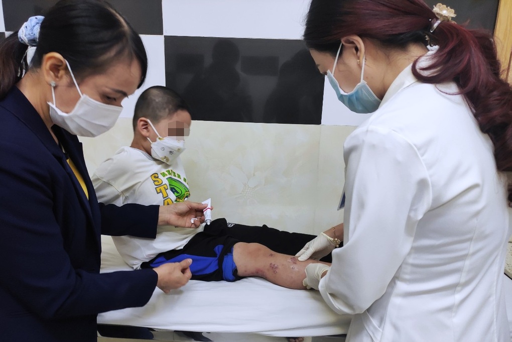 Hàng loạt trẻ ở TPHCM mắc bệnh rỉ dịch da cận ngày đi học - 3 Hàng loạt trẻ ở TPHCM mắc bệnh rỉ dịch da cận ngày đi học - 3