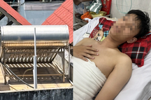 Ngã vào máy nước nóng năng lượng mặt trời, chàng trai bỏng nặng nửa người