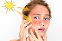 Thu hồi kem chống nắng kém chất lượng, chỉ số chống nắng "có như không"