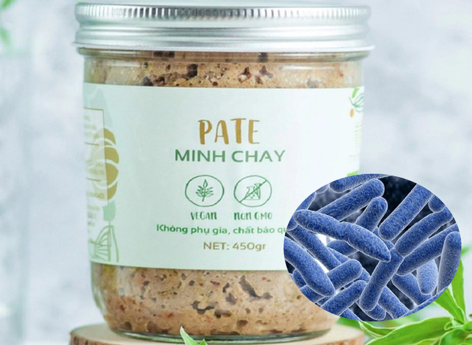 Botulinum trong pate Minh Chay: Chất độc sinh học mạnh nhất từng biết đến! - 1 Botulinum trong pate Minh Chay: Chất độc sinh học mạnh nhất từng biết đến! - 1