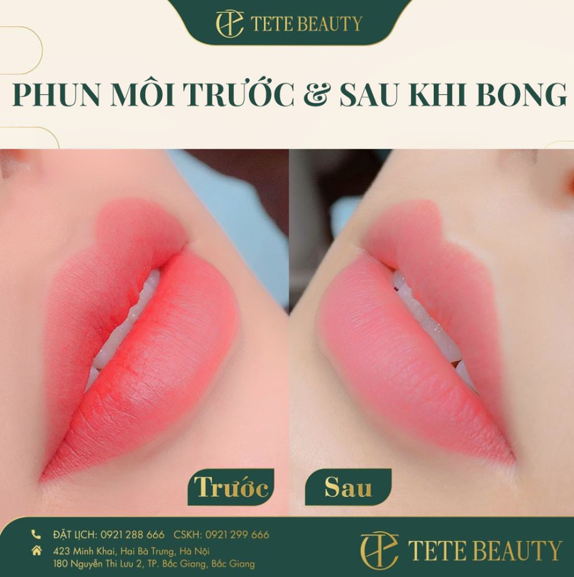 Tete Beauty với kỹ thuật phun môi hiện đại từ châu Âu - 4 Tete Beauty với kỹ thuật phun môi hiện đại từ châu Âu - 4