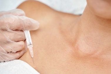 Sau nâng ngực, người phụ nữ hốt hoảng khi bác sĩ hút ra hơn 2 lít dịch viêm