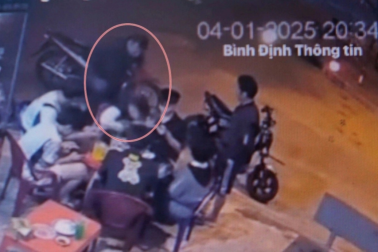 مورد ضرب و شتم مکرر پسری در بین دین: او وقتی چشمانش را بست تا بخوابد، وحشت کرد - 1 Vụ bé trai ở Bình Định bị đánh tới tấp: Nhắm mắt ngủ là giật mình - 1