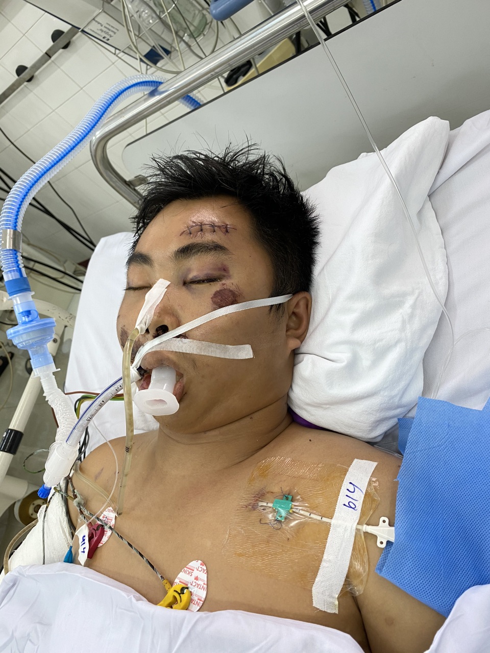 Chàng trai chống giặc Covid-19 qua đời trong sự tiếc thương vô hạn! - 1 Chàng trai chống giặc Covid-19 qua đời trong sự tiếc thương vô hạn! - 1