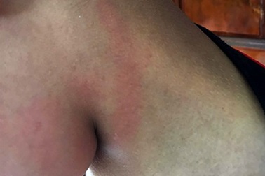 Con bị cắn ở trường, phụ huynh đến tận nhà tát cháu bé 9 tuổi