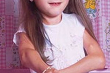 Bé gái "người hoá gỗ"