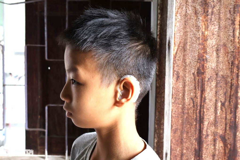 Vợ bất lực nhìn chồng chấn thương nặng vì mưu sinh, con trai khuyết tật - 3 Vợ bất lực nhìn chồng chấn thương nặng vì mưu sinh, con trai khuyết tật - 3