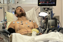 Chuyên gia bắt rắn nguy kịch sau cú đớp của rắn hổ