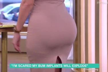 Nổi tiếng “bất đắc dĩ” vì… phẫu thuật thẩm mỹ hỏng