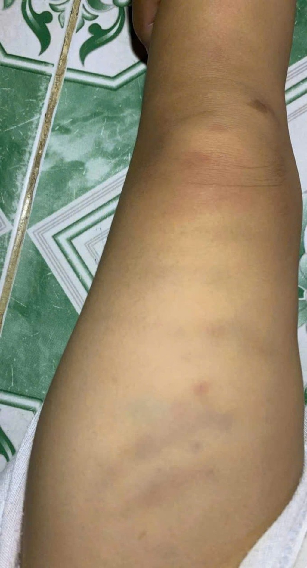 Công an điều tra vụ cháu bé nghi bị bạo hành ở nhóm giữ trẻ tại Bình Thuận - 1 Công an điều tra vụ cháu bé nghi bị bạo hành ở nhóm giữ trẻ tại Bình Thuận - 1