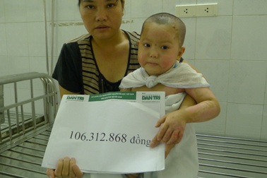 Hơn 100 triệu đồng đến với hai anh em bị bỏng rơm