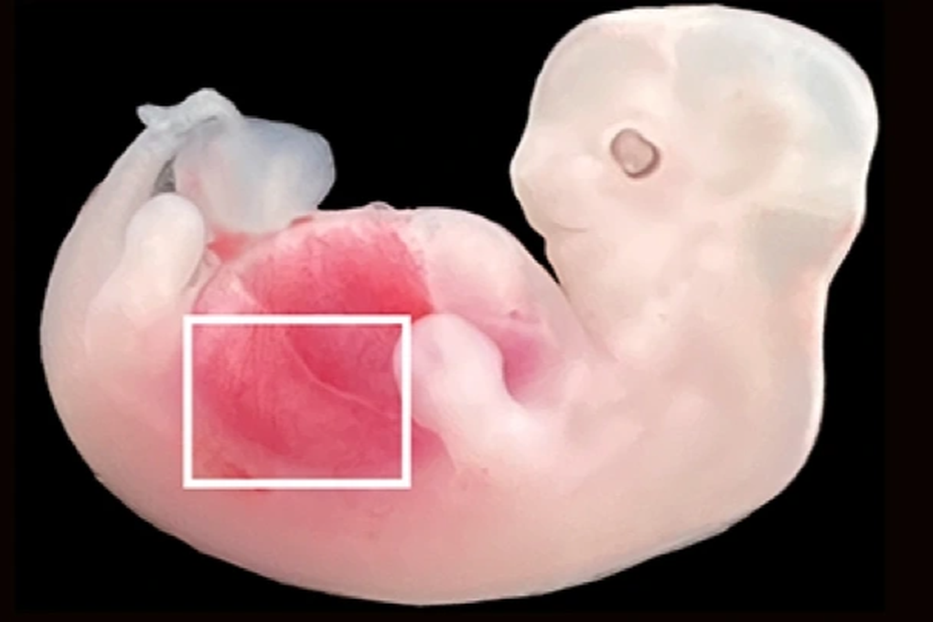 Tranh cãi việc cấy tế bào người vào thận lợn, phát triển trong bào thai lợn - 1 Tranh cãi việc cấy tế bào người vào thận lợn, phát triển trong bào thai lợn - 1