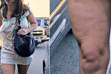 Những khoảnh khắc "khó coi" nhất của “sao”