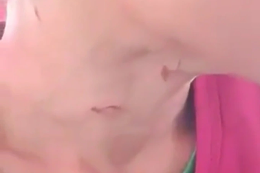 Bé trai 14 tuổi nghi bị cha dượng đốt "vùng kín"