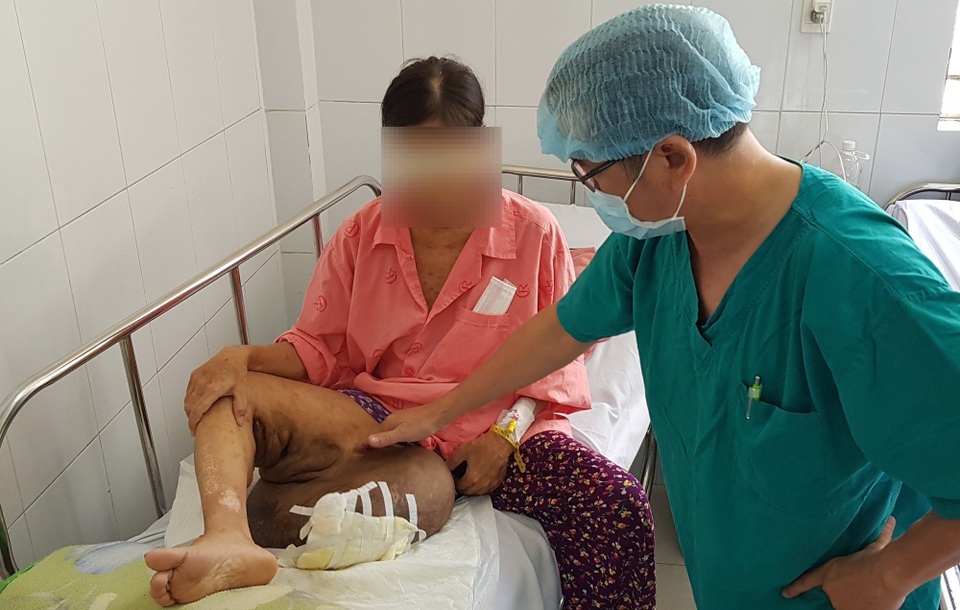 Mang khối bướu khổng lồ vẫn liều mình sinh con để… dưỡng già - 2 Mang khối bướu khổng lồ vẫn liều mình sinh con để… dưỡng già - 2