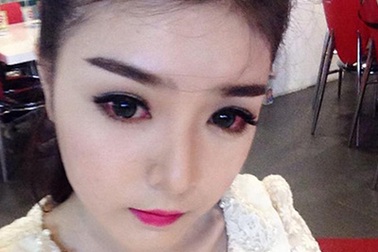 "Hotgirl" gặp họa từ kính áp tròng, bạn trẻ giật mình lo lắng