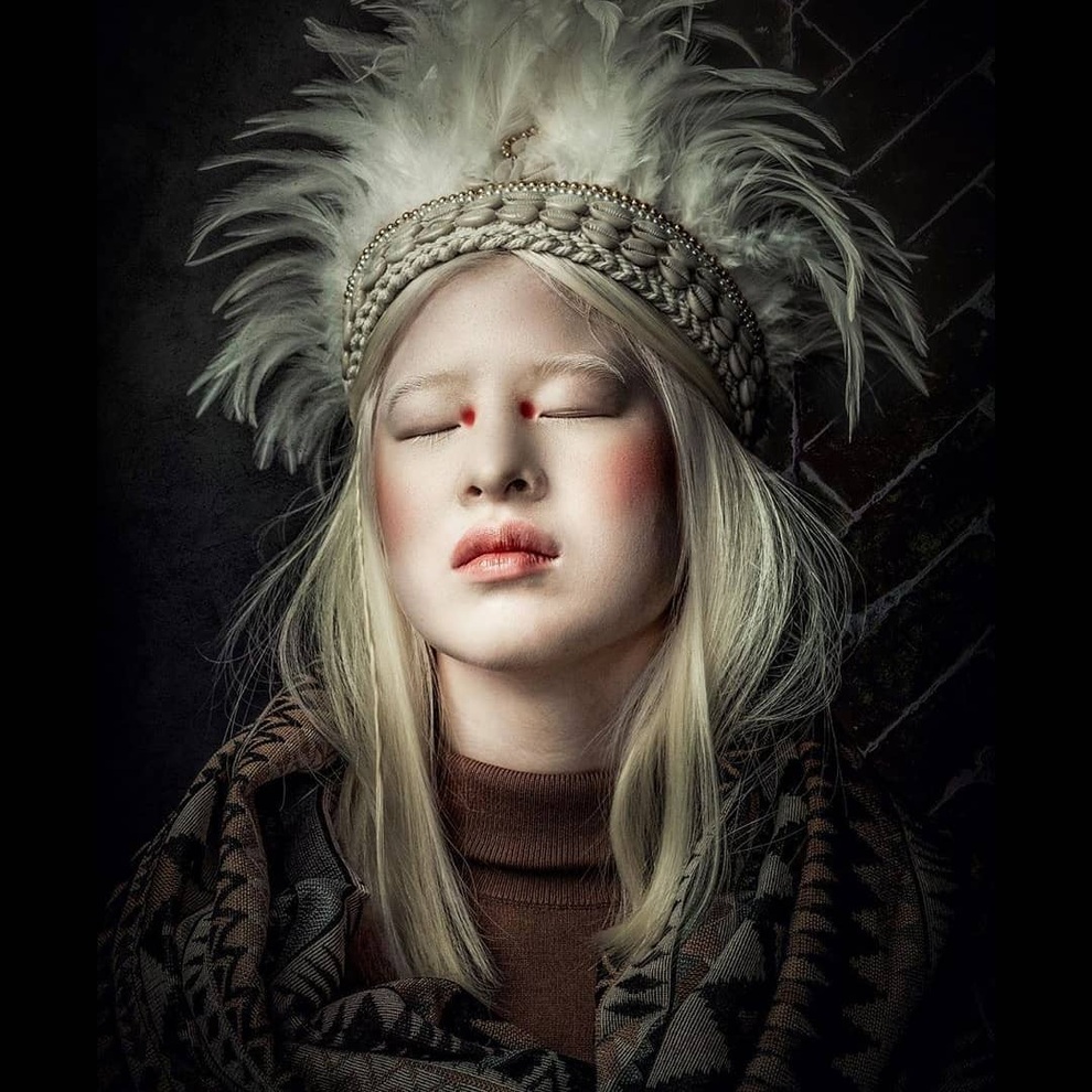 Cô gái bạch tạng từng bị cha mẹ bỏ rơi, trở thành người mẫu tạp chí Vogue - 6