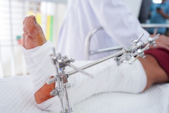 TPHCM: Nhiều người gặp tai nạn đứt lìa chi, bàn chân bị nghiền nát