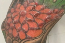 Nam thanh niên nhập viện vì ngứa điên dại sau xăm nghệ thuật