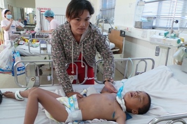 Cậu bé Khơ-me “chết mòn” trước bệnh uốn ván