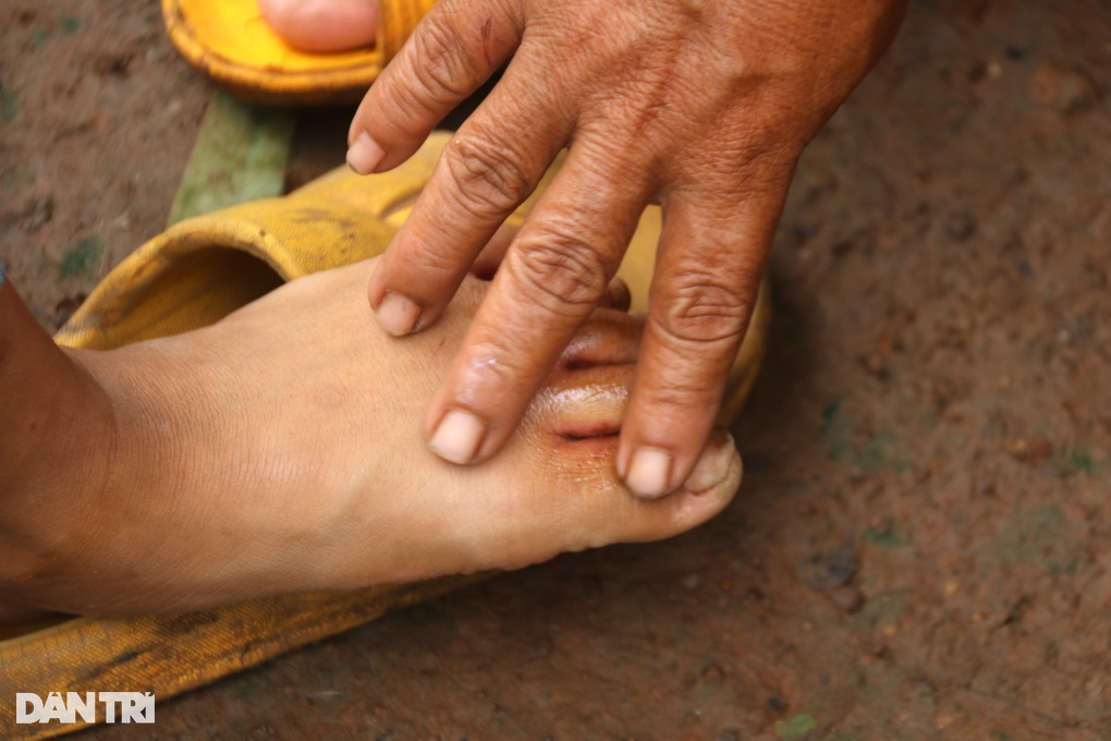 Hai đứa trẻ không cha, mơ một ngày không phải đi nhặt phân bò, bắt ốc - 6 Hai đứa trẻ không cha, mơ một ngày không phải đi nhặt phân bò, bắt ốc - 6
