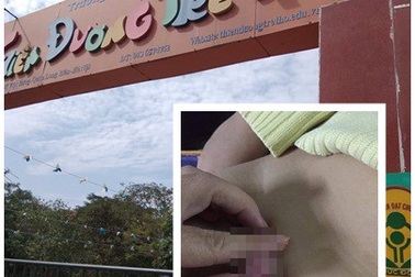 Bé mầm non tổn thương vùng kín: Nhà trường bảo “không liên quan tới cô giáo”?