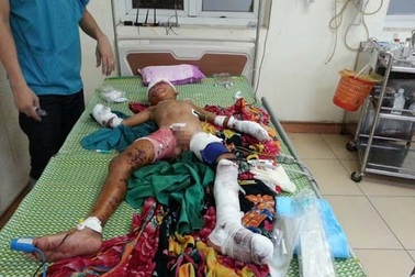 Hà Tĩnh: Nghịch vật lạ, 1 cháu bé bị thương nặng