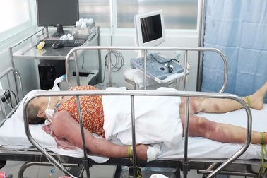 'Thầy' trừ tà đánh 2 'con bệnh' tơi tả