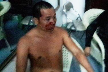 Bắt 6 đối tượng truy sát tài xế và phụ xe khách