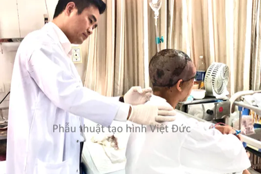 Người phụ nữ bị lột rời toàn bộ da đầu và nửa mặt được nối da ngoạn mục