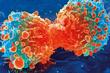 Xem tế bào ung thư “ăn thịt” đồng loại để sinh tồn