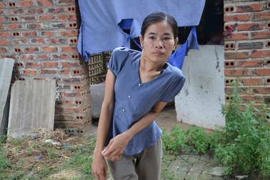 Hoàn cảnh éo le của cô gái lưng cong vẹo, chỉ ước một lần được về Hà Nội...