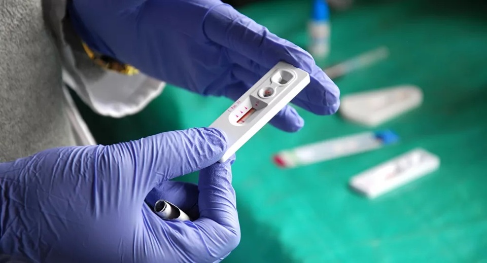 Bất ngờ với giả thuyết về nguồn gốc và hành trình lây lan HIV - 1 Bất ngờ với giả thuyết về nguồn gốc và hành trình lây lan HIV - 1