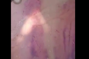 Người đàn ông mù là "đại gia"... ăn xin bị đánh bầm dập