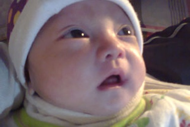 Bệnh tình bé Uyên Nhi ngày mỗi nặng hơn