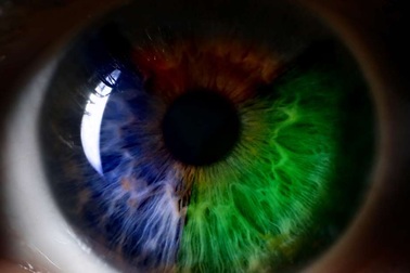 Kính áp tròng kiểu mới có thể giúp khắc phục bệnh mù màu