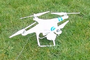 Dùng máy bay điều khiển từ xa để nhổ răng