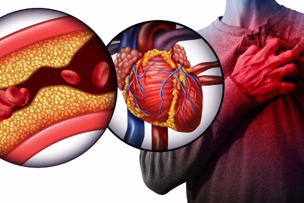 Căn bệnh khiến siêu mẫu Đức Tiến qua đời ở tuổi 44 nguy hiểm thế nào? - 2 Căn bệnh khiến siêu mẫu Đức Tiến qua đời ở tuổi 44 nguy hiểm thế nào? - 2